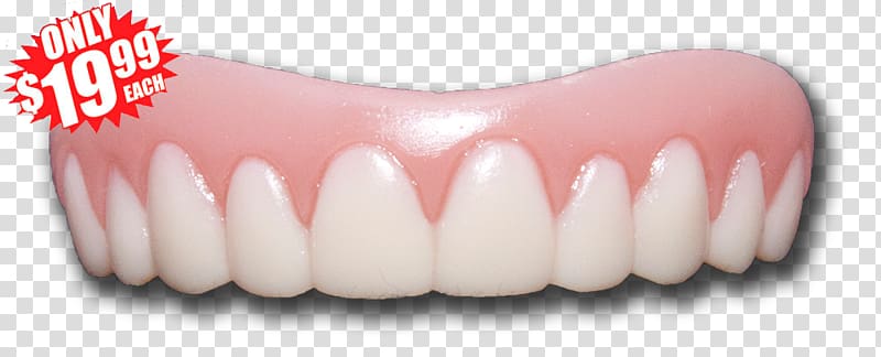 Human tooth Smile Veneer Cosmetic dentistry, smile transparent background PNG clipart
