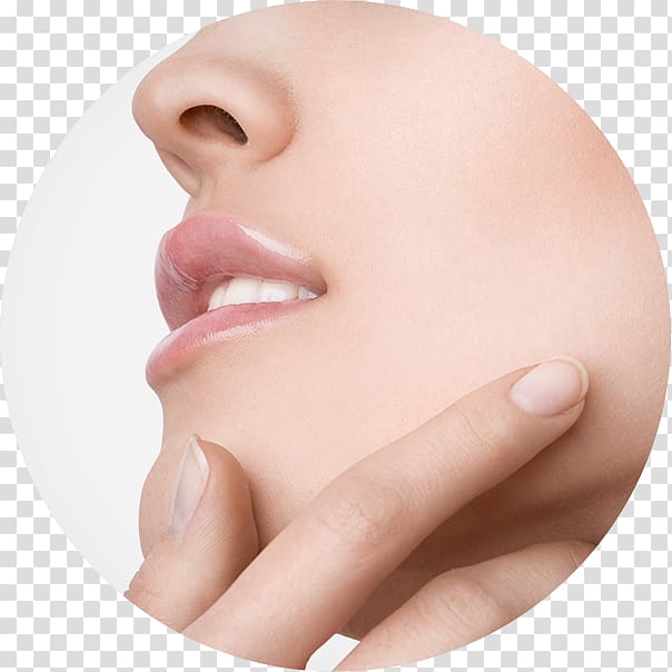 Melasma Forehead Cream Cheek Mouth, Nonsurgical Rhinoplasty transparent background PNG clipart