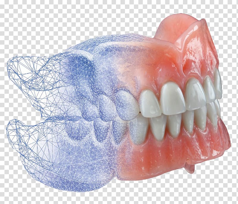 AvaDent Dentures CAD/CAM dentistry, crowns transparent background PNG clipart