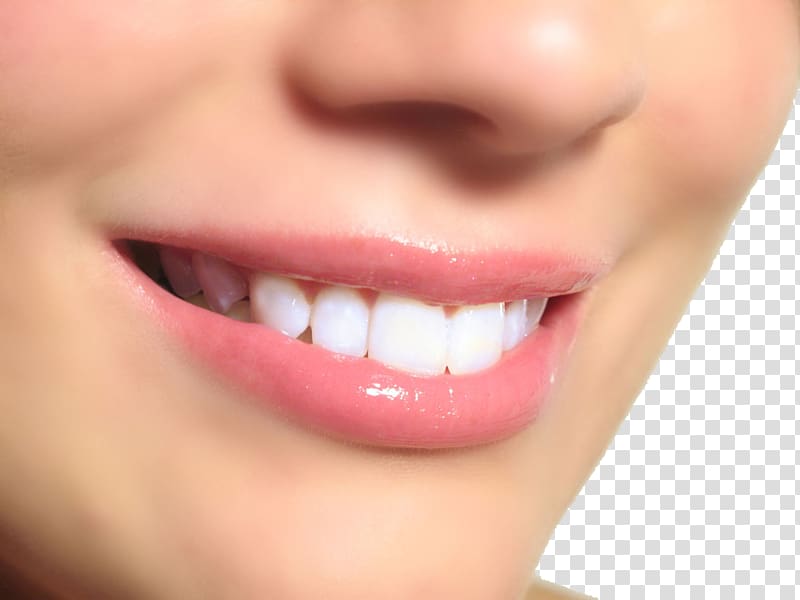 Tooth whitening Dentistry Tooth pathology, Teeth model transparent background PNG clipart