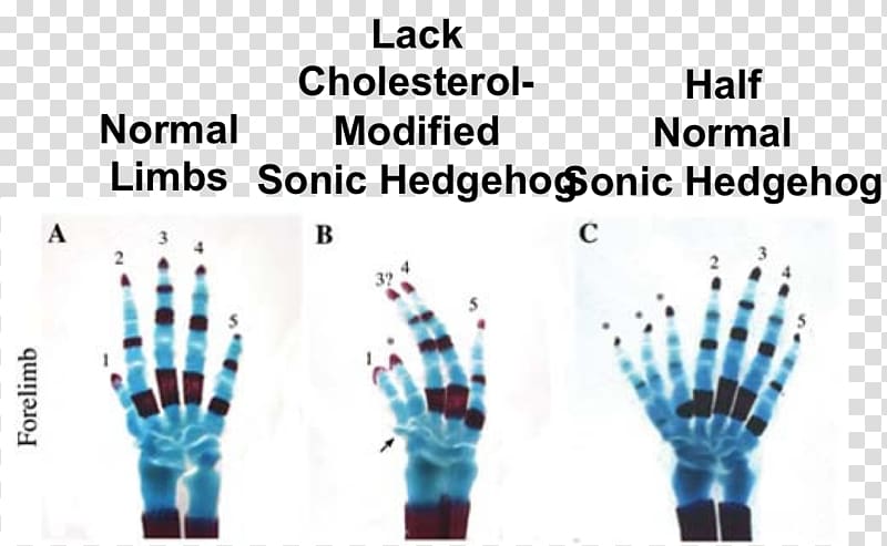 Sonic hedgehog GLI3 Mouse Hedgehog signaling pathway Polydactyly, mouse transparent background PNG clipart