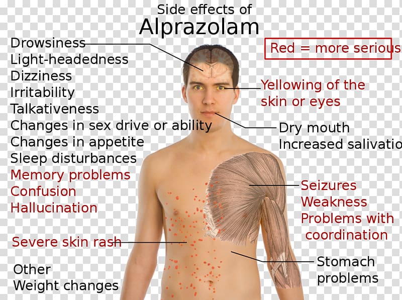 Alprazolam Adverse effect Sleep deprivation Pharmaceutical drug Diazepam, xanax transparent background PNG clipart