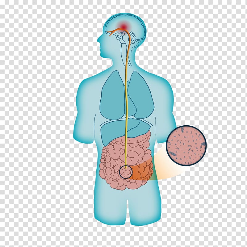 Anxiety disorder Parkinson disease dementia Depression, gut brain axis transparent background PNG clipart