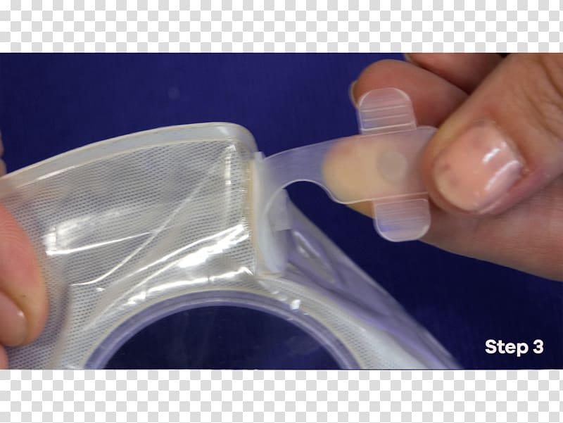 Stoma Colostomy Ostomy pouching system Laryngectomy, Bangkok Nurse Care Co Ltd transparent background PNG clipart