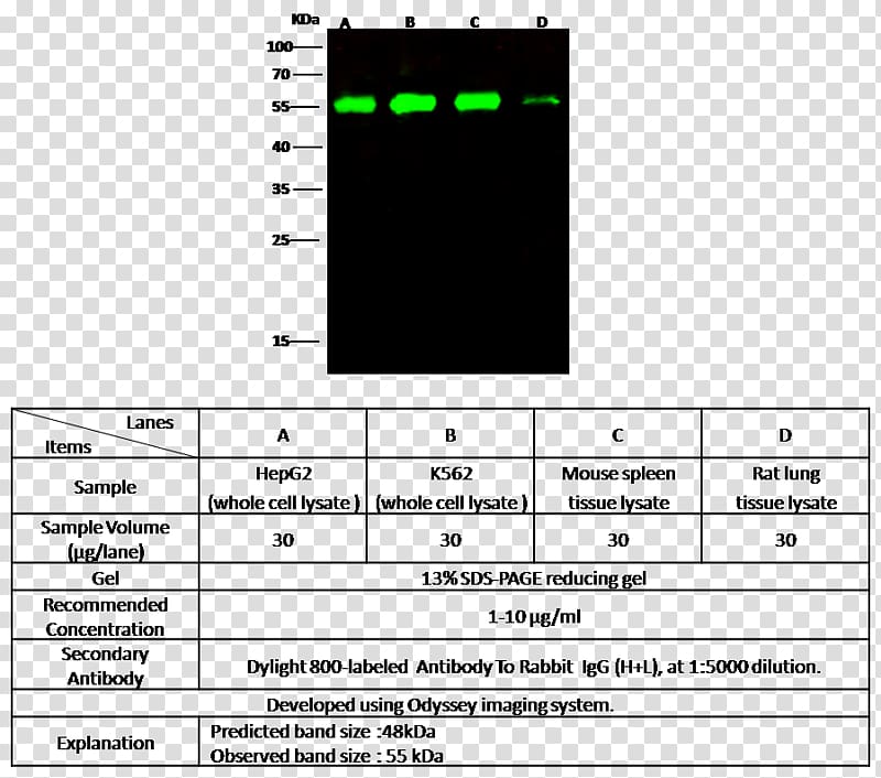 IL1B Interleukin-1 family Western blot ELISA Antibody, Mcf7 transparent background PNG clipart