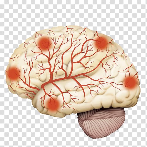 Disease Arteriosclerosis Cerebrum Intracranial aneurysm Brain, Hand-painted brain meridian map transparent background PNG clipart