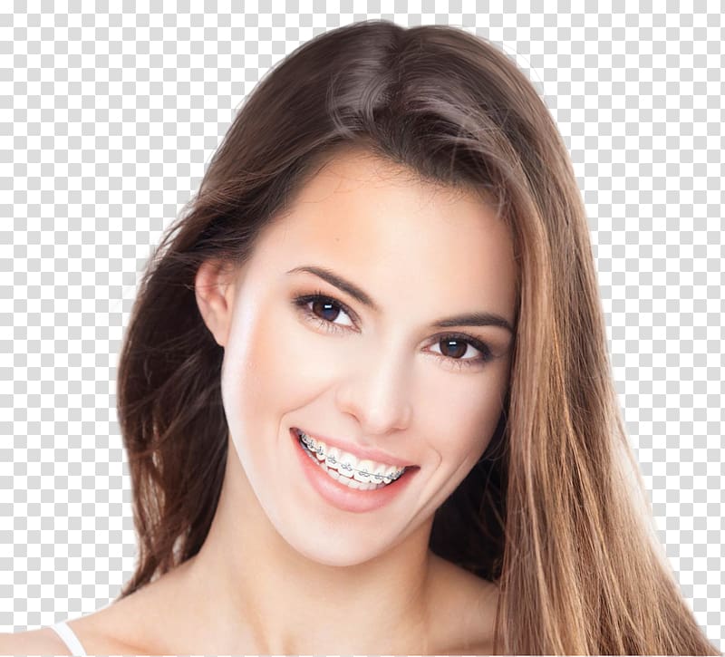 Orthodontics Palms Dental Centre Cosmetic dentistry, health transparent background PNG clipart