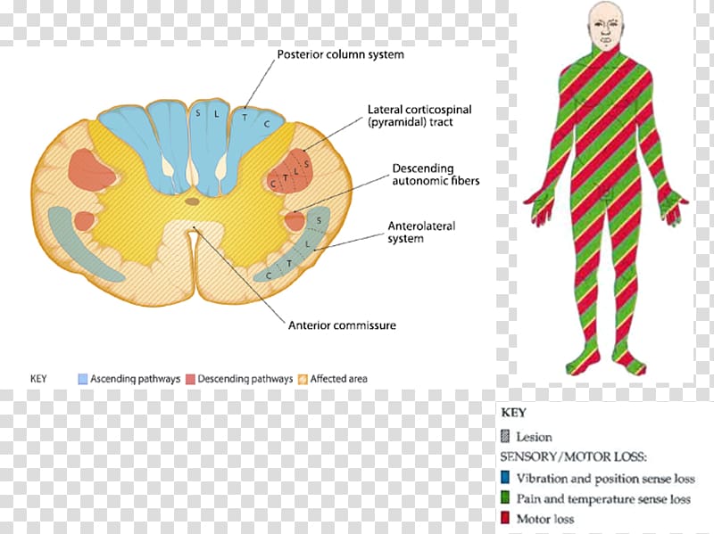 Graphic design Neuroanatomy Neuroscience Brain Ache, Fecal Incontinence transparent background PNG clipart