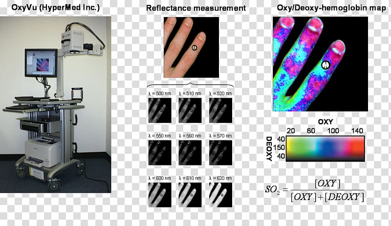 Journal of Biomedical Optics Hyperspectral imaging Biomedical engineering Diabetic foot, Biomedical transparent background PNG clipart