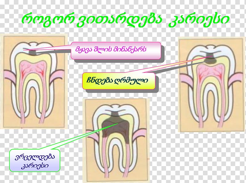 Tooth 0 AD 2, Yn transparent background PNG clipart
