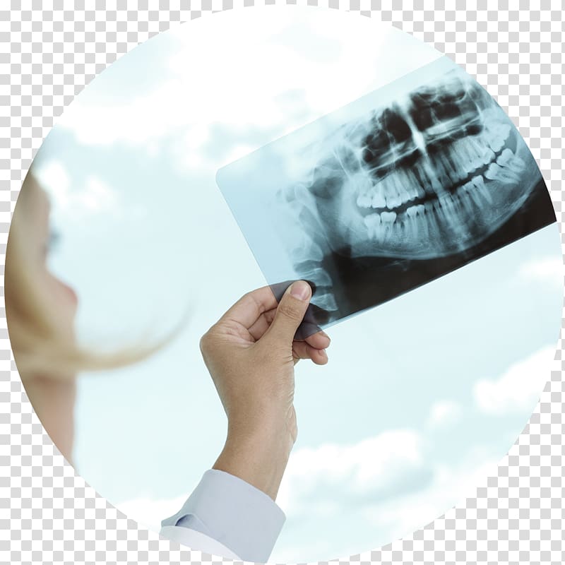 Dentistry Dental implant Dental surgery Oral and maxillofacial surgery, crown transparent background PNG clipart