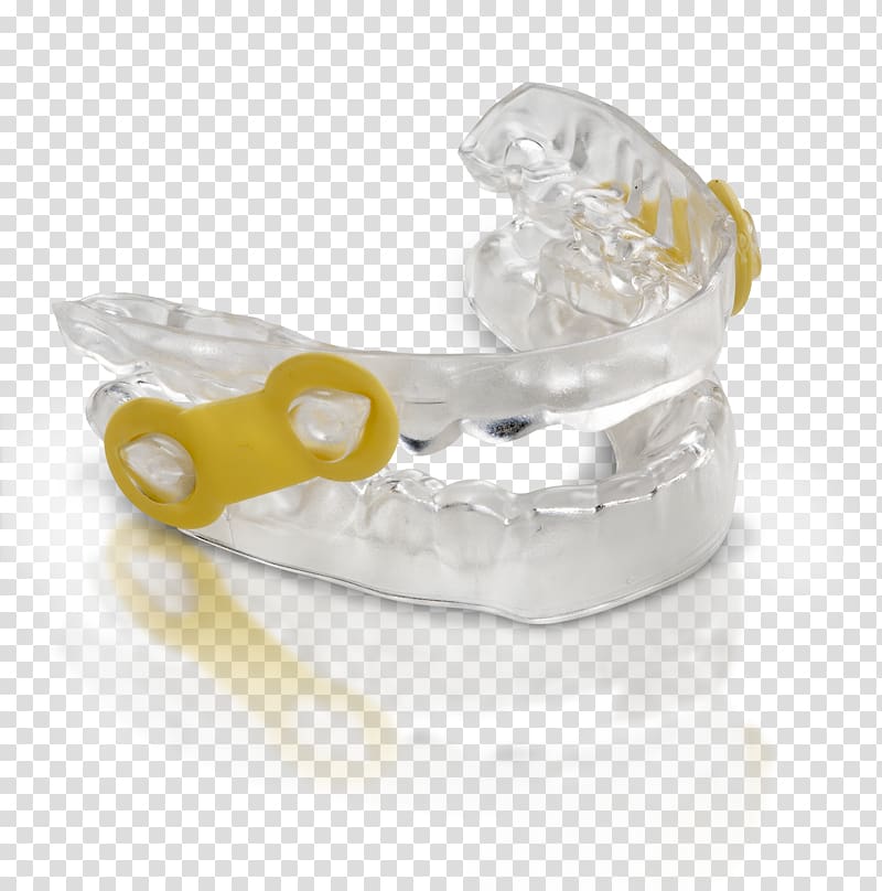 Mandibular advancement splint Dentistry Therapy Patient, mandibular advancement splints transparent background PNG clipart
