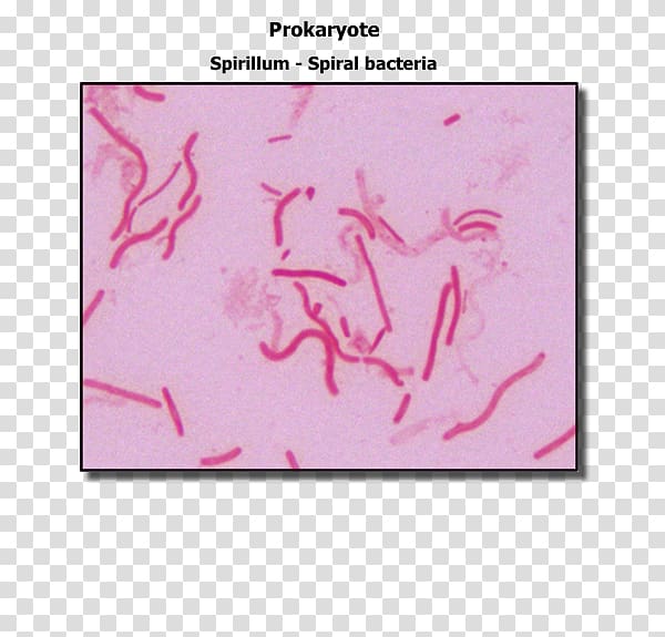 Staining Spirillum Gram-negative bacteria Gram stain Gram-positive bacteria, micro transparent background PNG clipart
