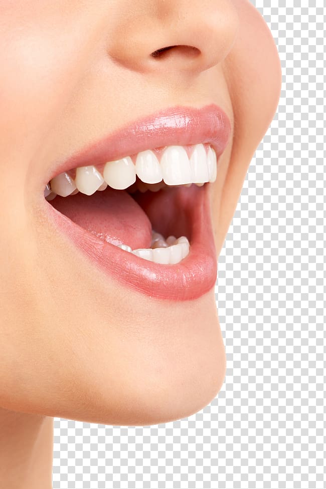 woman's mouth, Dentistry Veneer Dental hygienist Crown, Teeth model transparent background PNG clipart