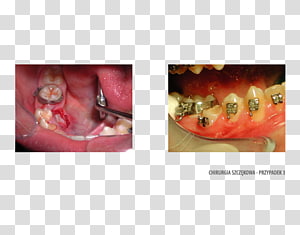 Nail transparent background PNG clipart thumbnail