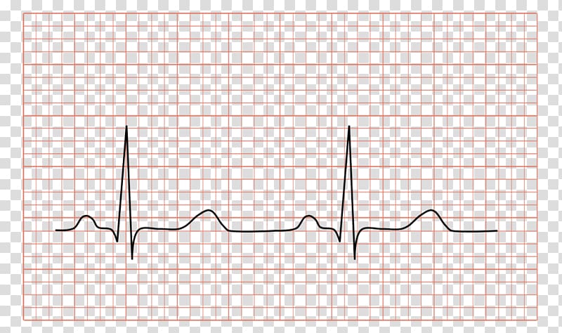 Electrocardiography Electrocardiogram Cardiology Heart Medicine, heart transparent background PNG clipart