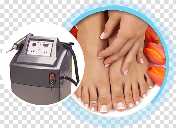 Toe ring Foot Nail Onychomycosis, laser Treatment transparent background PNG clipart