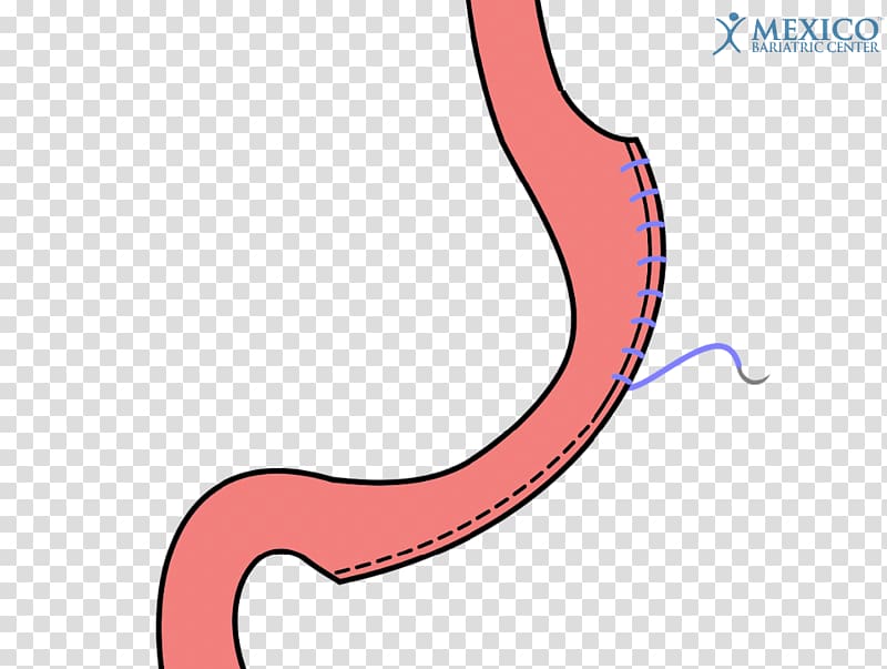 Stomach Mouth , sleeve gastrectomy transparent background PNG clipart