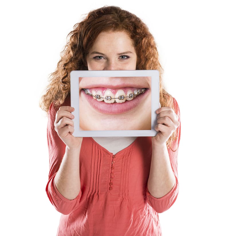 woman holding brace teeth , Dental braces Dentistry Orthodontics Clear aligners, teeth transparent background PNG clipart
