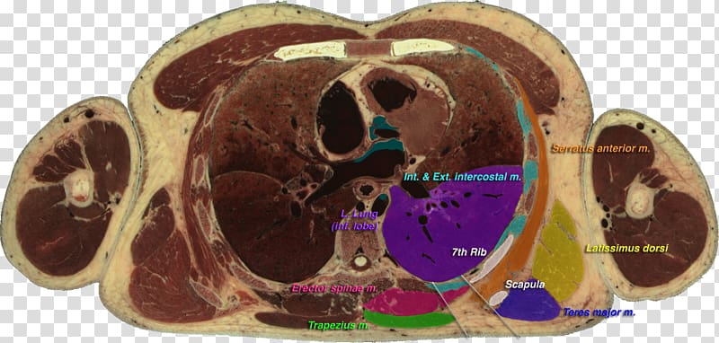 Visible Human Project Triangle of auscultation Foundational Model of Anatomy Thoracic vertebrae, heart transparent background PNG clipart