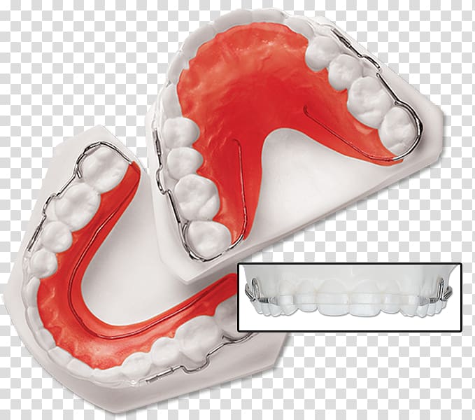 Tooth Retainer Orthodontics Dentistry Dental braces, retainer transparent background PNG clipart