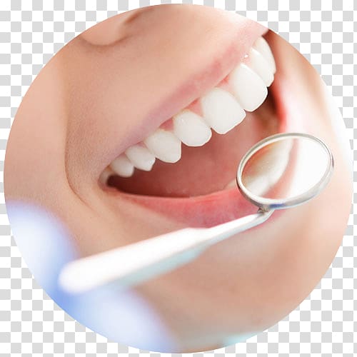Cosmetic dentistry Oral and maxillofacial surgery, papatya transparent background PNG clipart