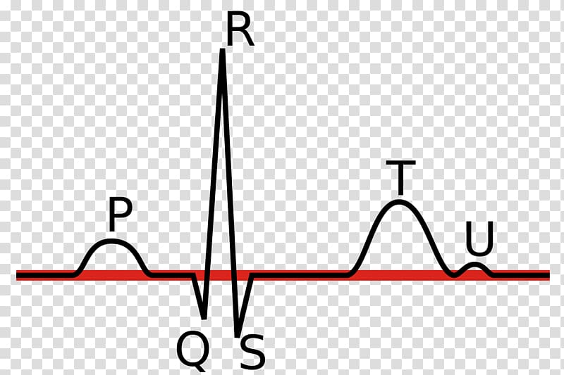 Electrocardiography Linia izoelektryczna P wave QRS complex Heart rate, Ekgmonitoring transparent background PNG clipart