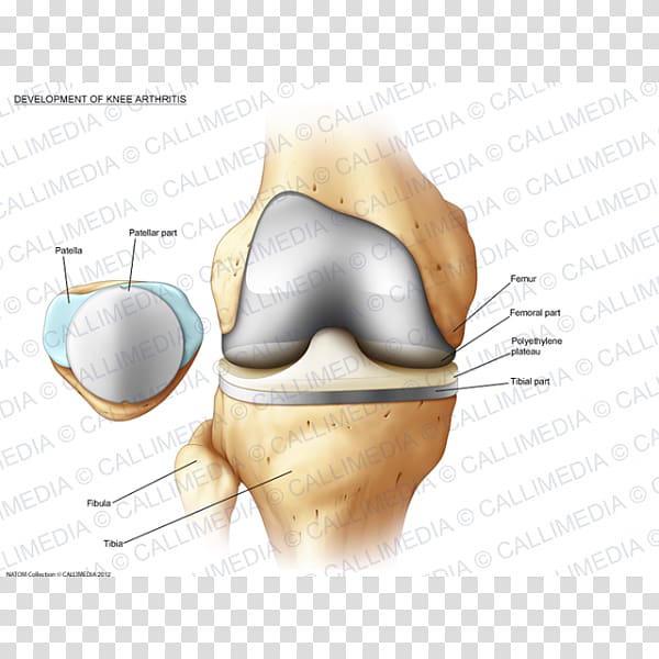 Bone fracture Jaw Ear Human tooth, Muscular Development transparent background PNG clipart