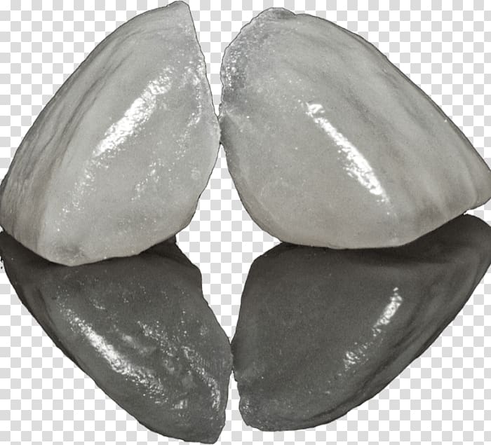 Veneer Cosmetic dentistry Patient Crown Dental restoration, veneers transparent background PNG clipart