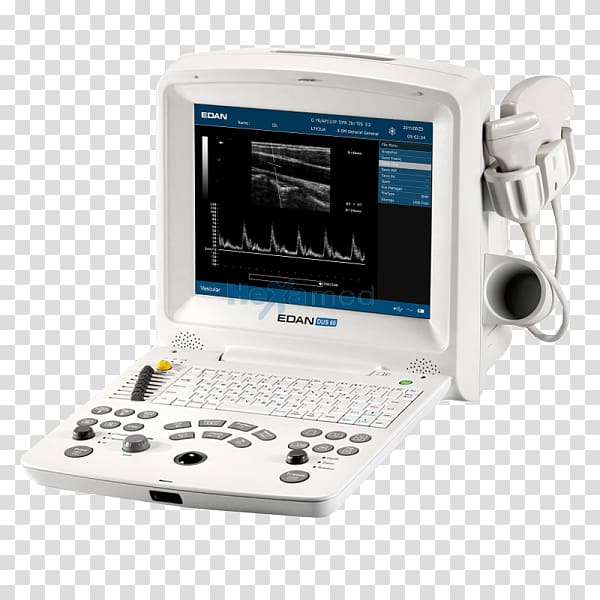 Diagnostic Ultrasound Ultrasonography Medical imaging Medicine, ultrasound machine transparent background PNG clipart