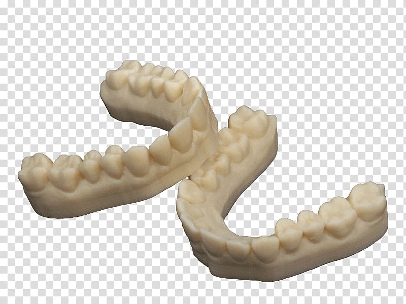 3D printing Dentistry Dental composite Crown, 3d tooth repair transparent background PNG clipart