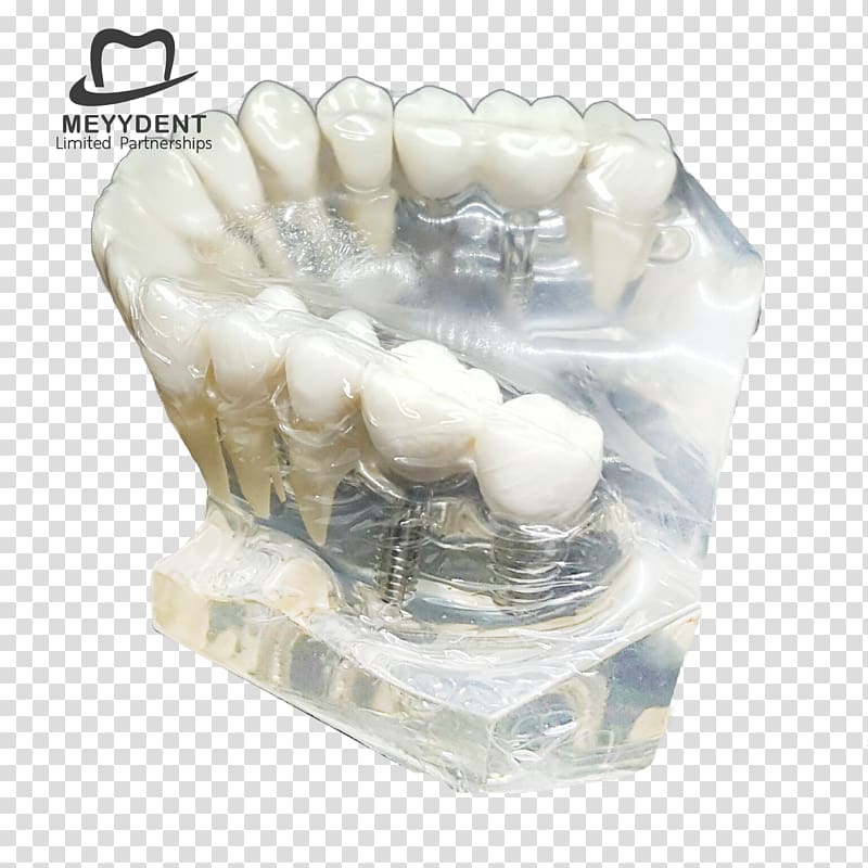 Human tooth Dental laboratory หจก.เมย์เด้นท์ Jaw, dental model transparent background PNG clipart