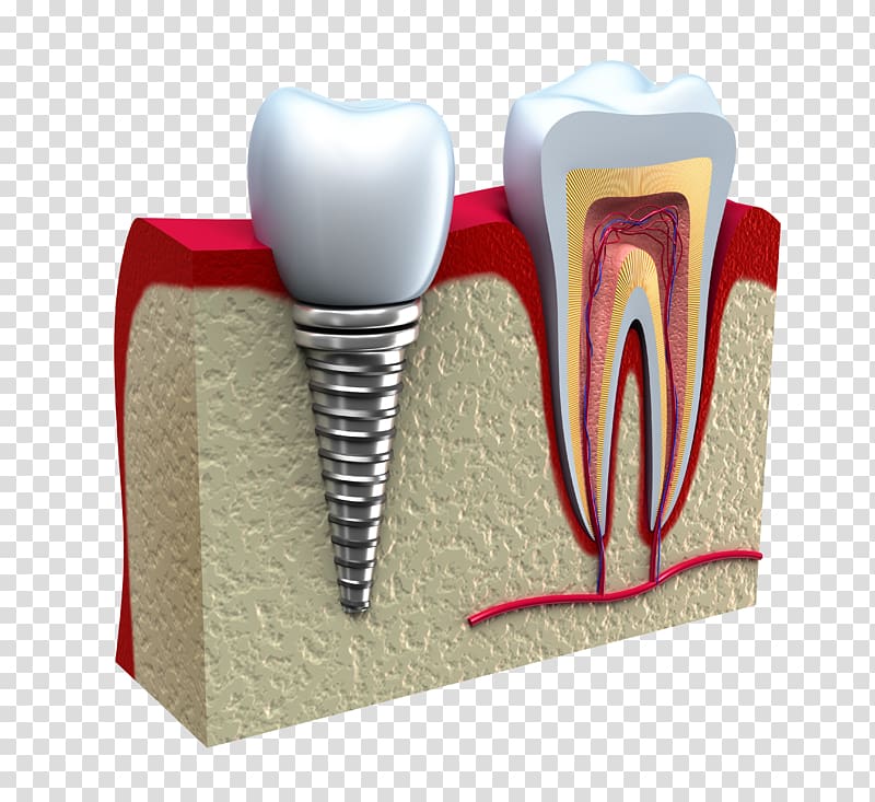 dental model transparent background PNG clipart