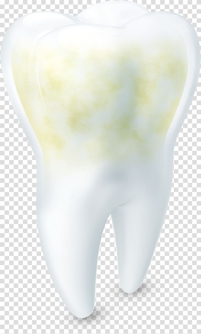 Tooth enamel Tooth wear Tooth decay Acid, yellow teeth transparent background PNG clipart