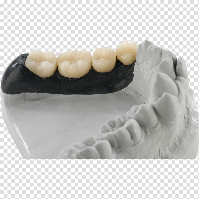 Dentist Dental technician Dental laboratory Anatomická pinzeta Zahntechnik, multilayer transparent background PNG clipart