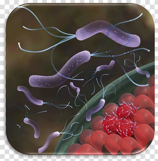 Helicobacter Pylori Infection Helicobacter pylori eradication protocols Peptic ulcer disease, Helicobacter Pylori Eradication Protocols transparent background PNG clipart