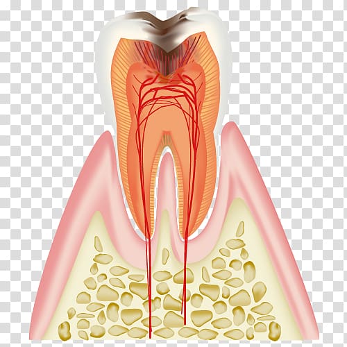 歯科 Dentist Tooth decay Periodontal disease, dental caries transparent background PNG clipart