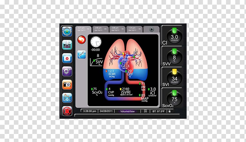 Cardiac output Intensive Care Medicine PiCCO Edwards Lifesciences Monitoring, Physiology transparent background PNG clipart