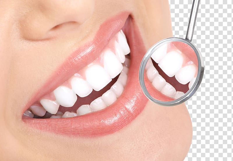 smiling woman near dental tool, Tooth whitening Tooth decay Therapy Dentist, Dentist Smile HD transparent background PNG clipart