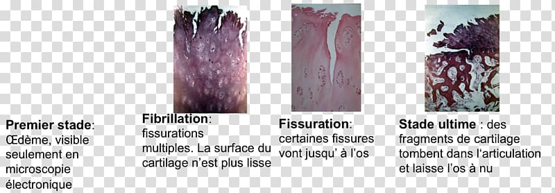 Hair coloring Cartilage Joint Translation, macrophage transparent background PNG clipart