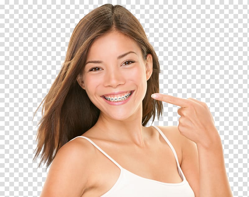 Dental braces Dentistry Clear aligners Orthodontics, Hygienist transparent background PNG clipart
