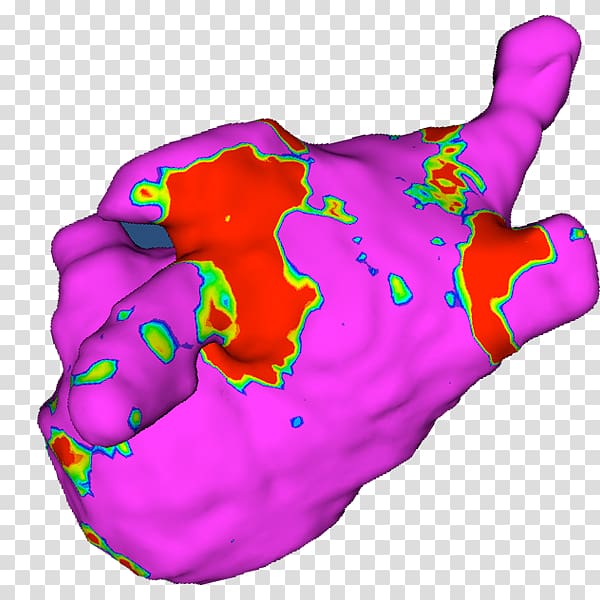 Atrial fibrillation Heart arrhythmia Atrial flutter Paroxysmal tachycardia, others transparent background PNG clipart