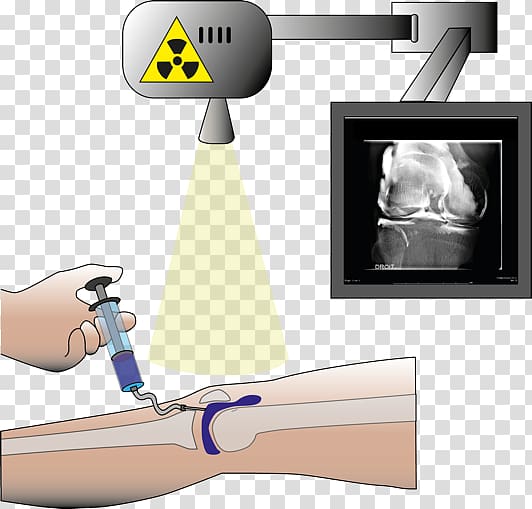 Injection Radiology Arthrogram Computed tomography Magnetic resonance imaging, St. Thomas transparent background PNG clipart