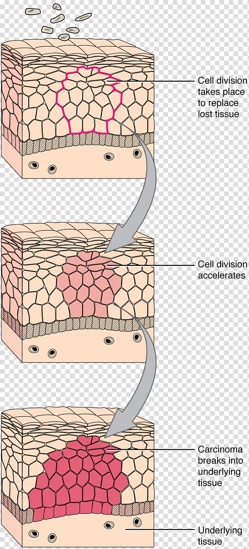 Transitional epithelium Connective tissue Cell, TISSUE transparent background PNG clipart
