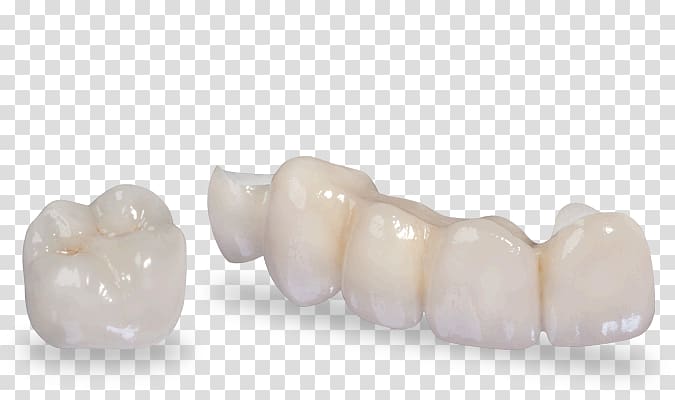 Crown Zirconium dioxide Dentistry Tooth, crown transparent background PNG clipart