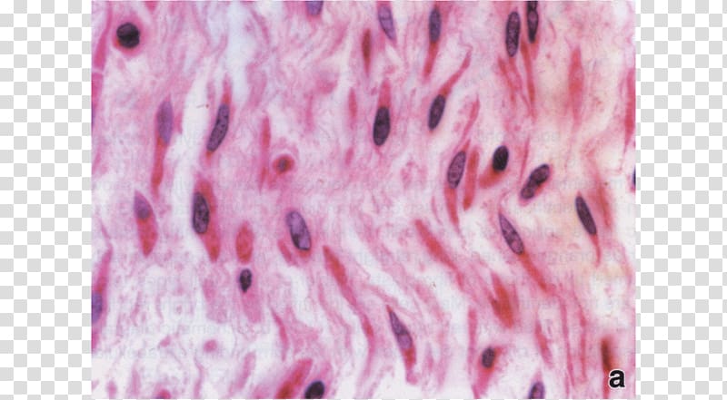 Mesenchyme Connective tissue Extracellular matrix, irregular border transparent background PNG clipart