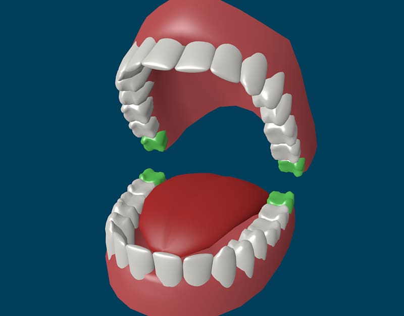 Human tooth Wisdom tooth Homo sapiens Deciduous teeth, Tooth transparent background PNG clipart