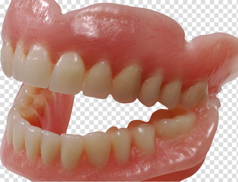 Human tooth Dentures , Tooth transparent background PNG clipart