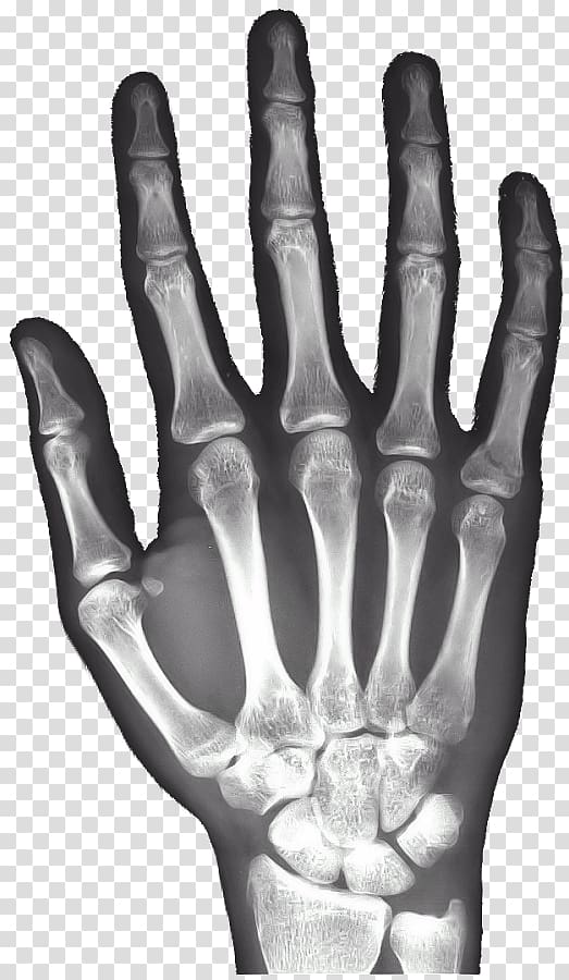 x-ray of hand bone clipa rt, X-ray Hand Carpal bones Android, rays transparent background PNG clipart