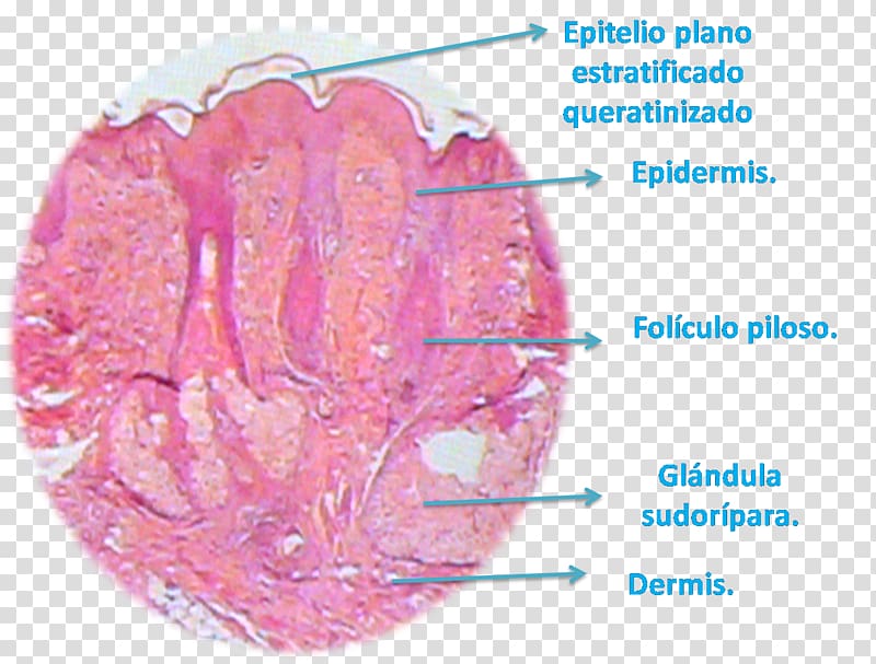 Histology Reticular dermis Lip Papillary dermis, dermis transparent background PNG clipart